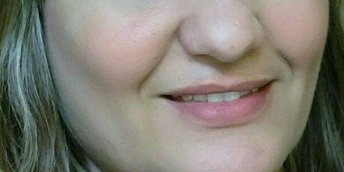 DENTAL KOH Mexicali
