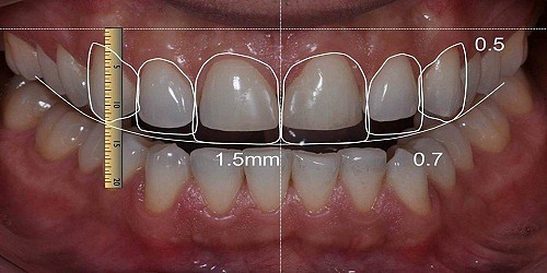 ARMONÍA DENTAL CLÍNICA ODONTOLOGICA