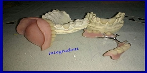 INTEGRADENT