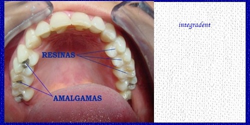 INTEGRADENT