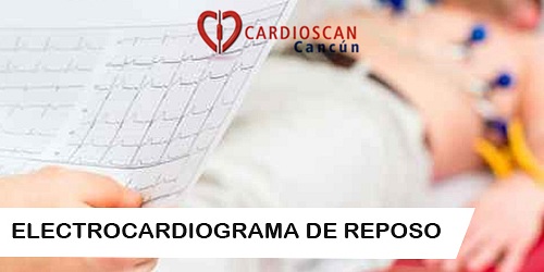 CARDIÓLOGO INTERVENCIONISTA EN CANCÚN DR. MAURICIO CASTILLO