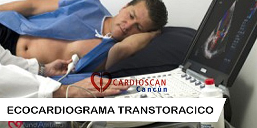 CARDIÓLOGO INTERVENCIONISTA EN CANCÚN DR. MAURICIO CASTILLO