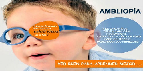 Optica Viva Vision