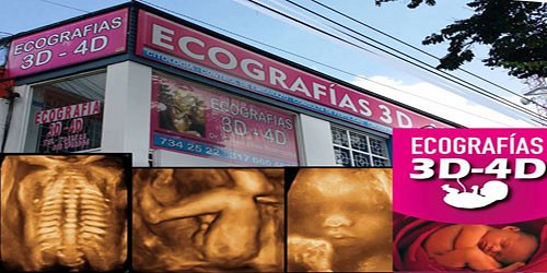 DR. RUBEN ELÍAS  RODRIGUEZ ECOGRAFÍAS 3D-4D