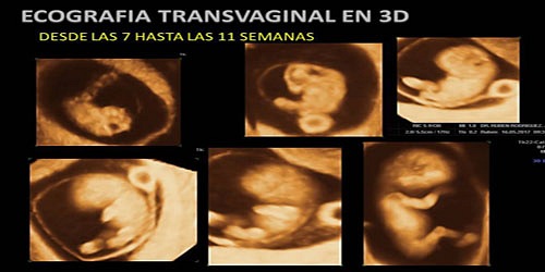 DR. RUBEN ELÍAS  RODRIGUEZ ECOGRAFÍAS 3D-4D