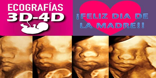 DR. RUBEN ELÍAS  RODRIGUEZ ECOGRAFÍAS 3D-4D