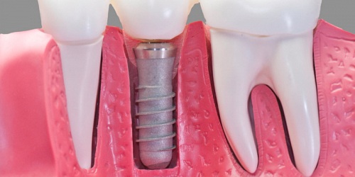Sonrisa Perfecta Centro Dental