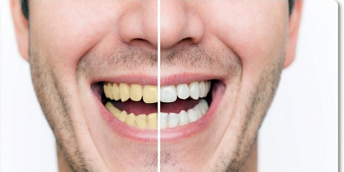 Sonrisa Perfecta Centro Dental