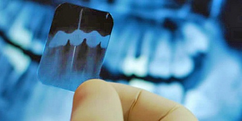 DENTAL SOL Endodoncia