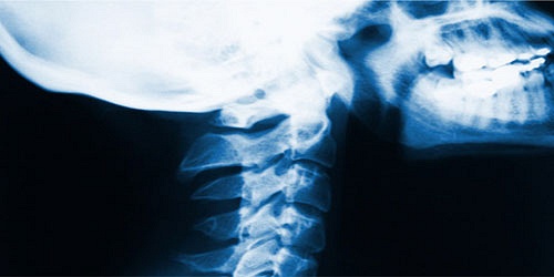SANUS CLÍNICA DEL DOLOR