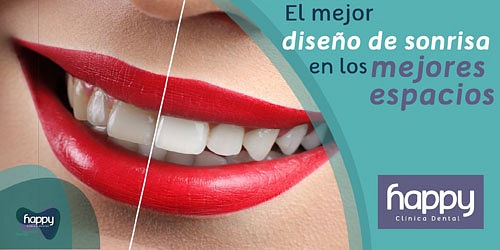 Happy Clínica Dental