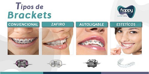 Happy Clínica Dental