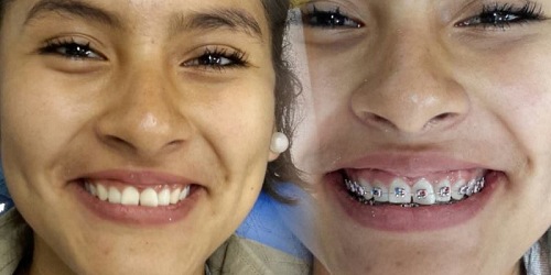 OdontoPlus Ibarra