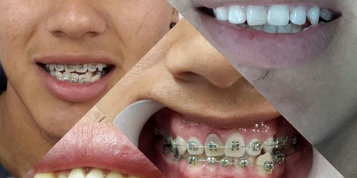 OdontoPlus Ibarra
