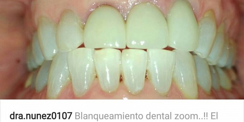Clinica Dental Franco Nunez Cirugias y Odontologia Panama