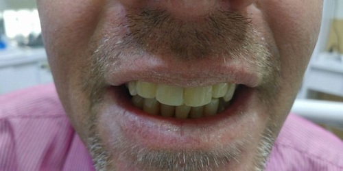Clinica Dental Franco Nunez Cirugias y Odontologia Panama