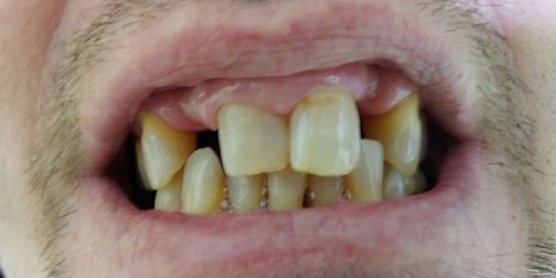 Clinica Dental Franco Nunez Cirugias y Odontologia Panama