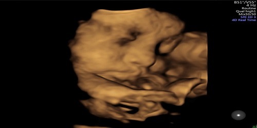 Médico Ginecólogo Obstetra-Ecografías 3D-4D-Ultrasonografía