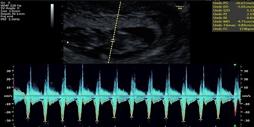 Médico Ginecólogo Obstetra-Ecografías 3D-4D-Ultrasonografía