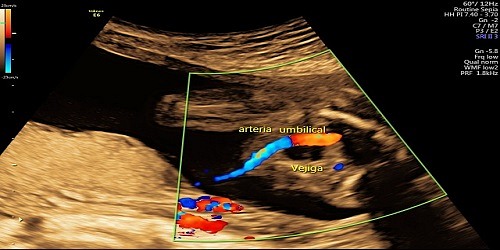 Médico Ginecólogo Obstetra-Ecografías 3D-4D-Ultrasonografía
