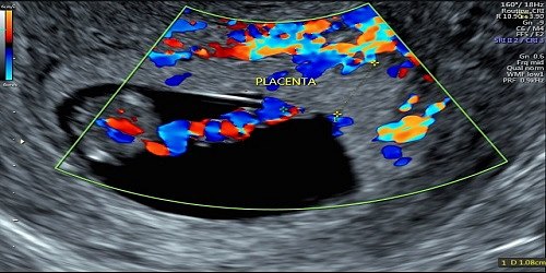 Médico Ginecólogo Obstetra-Ecografías 3D-4D-Ultrasonografía