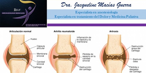 Dra. Jacqueline Macias Guerra-Tratamiento del Dolor