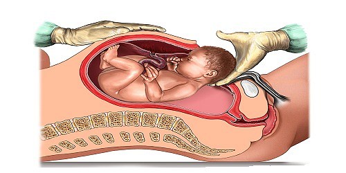 Médico Ginecólogo Obstetra-Ecografías 3D-4D-Ultrasonografía