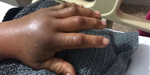 Ortopedista Infantil y Traumatólogo Dr. Macario Ramos