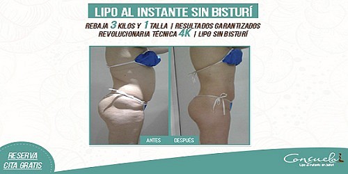 CONSUELO ESTÉTICA