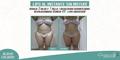 CONSUELO ESTÉTICA