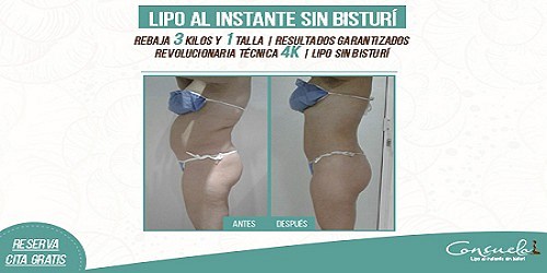 CONSUELO ESTÉTICA