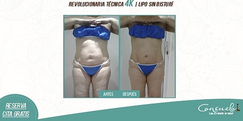 CONSUELO ESTÉTICA