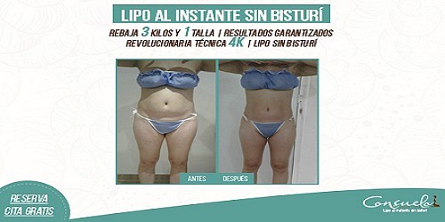 CONSUELO ESTÉTICA