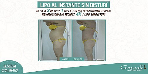 CONSUELO ESTÉTICA