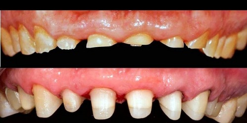 Dr. Eduardo Cedeño Viteri - Odontología Especializada