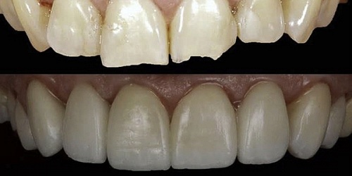 Dr. Eduardo Cedeño Viteri - Odontología Especializada