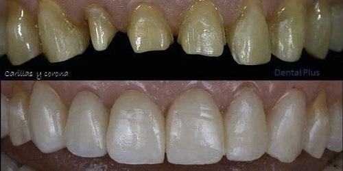 Dr. Eduardo Cedeño Viteri - Odontología Especializada