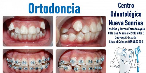 Nueva Sonrisa Centro Odontologico