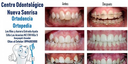 Nueva Sonrisa Centro Odontologico