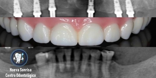 Nueva Sonrisa Centro Odontologico