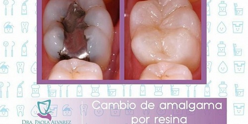 Dra. Paola Alvarez Odontología Estética Integral
