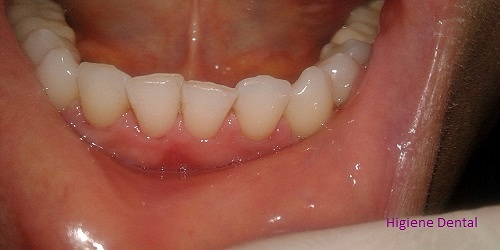 Dra. Paola Alvarez Odontología Estética Integral