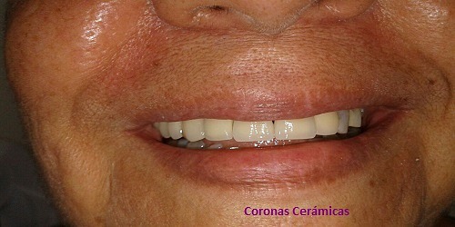 Dra. Paola Alvarez Odontología Estética Integral