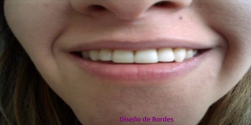 Dra. Paola Alvarez Odontología Estética Integral