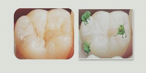 ODONTOMAP