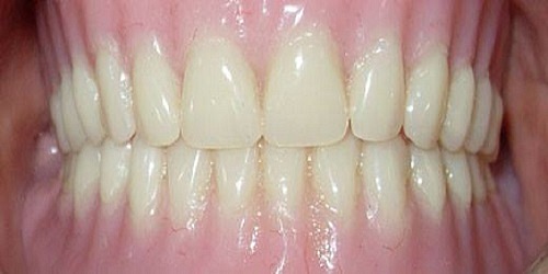 ODONTOMAP