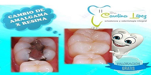 Dra Carolina Lopez Ortodoncia Odontología Cali