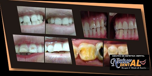 Centro de Estética Dental Natur Dental