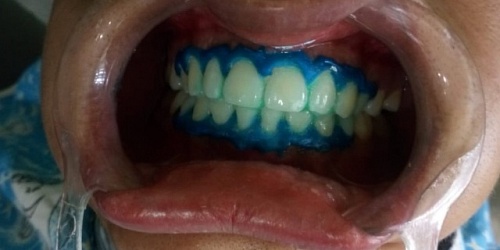 Ortodental