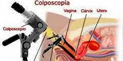 Dr. Alex Terán Cortéz Ginecólogo Obstetra